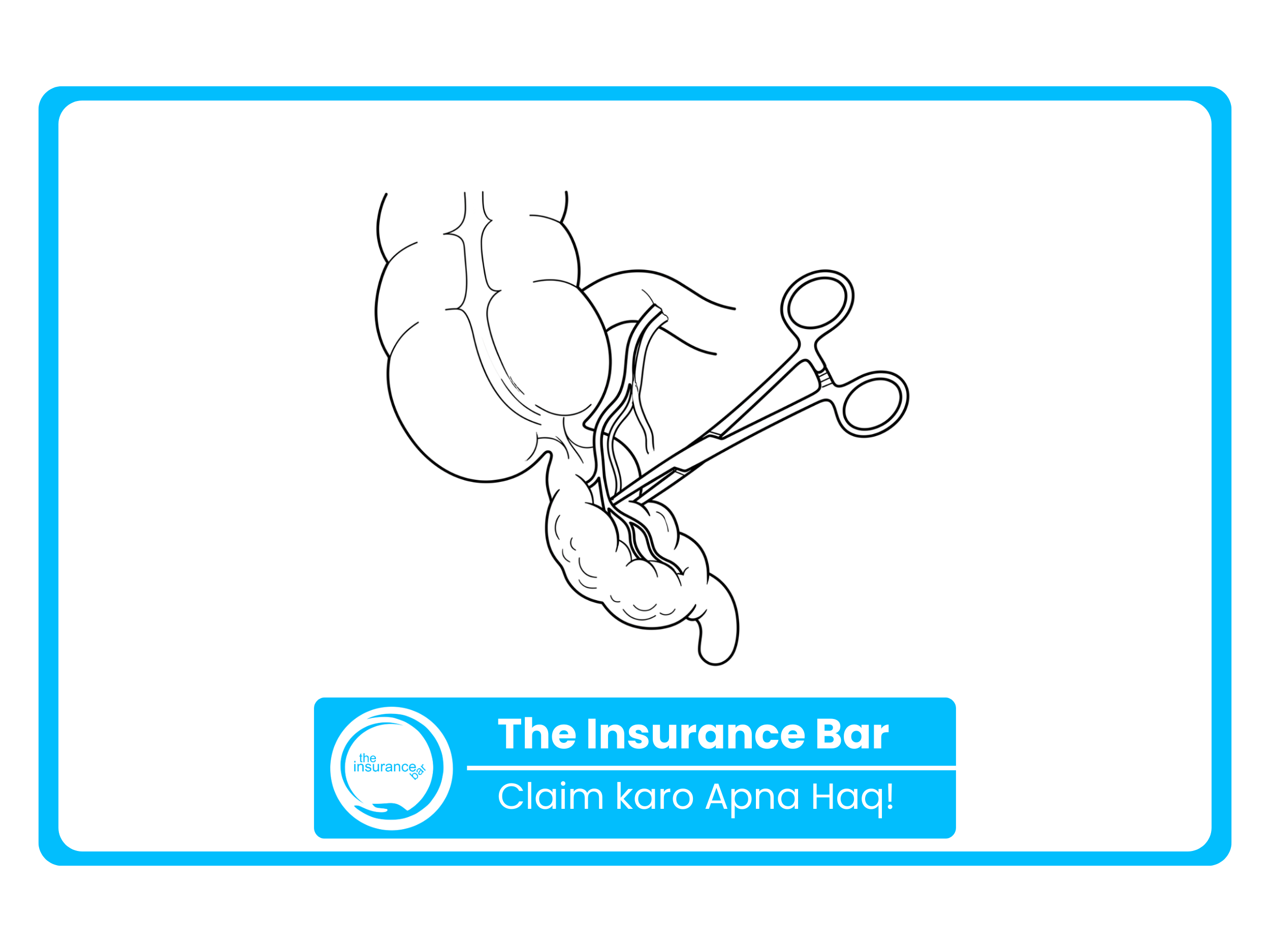 Overturning a ₹3.45L Denial for Emergency Appendectomy Under the 2-Year Exclusion Clause.